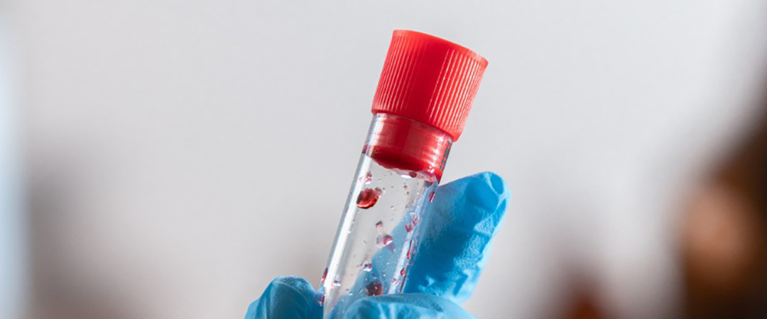 Molecular diagnosis of neglected parasitic diseases & malaria: Tools for the real world in AI era